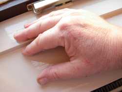 Healing a hand scratch with aloe