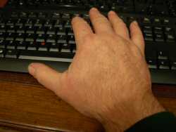 Healing a hand scratch with aloe